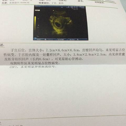 journal_insert_pic_932534024