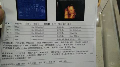 journal_insert_pic_932560220