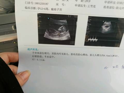 journal_insert_pic_932955391