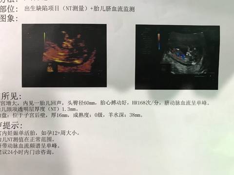 journal_insert_pic_935060759