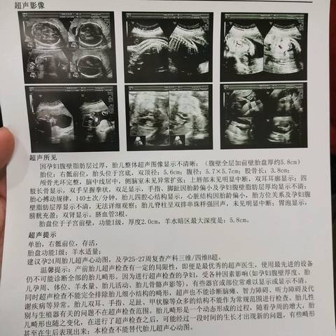 journal_insert_pic_935696296