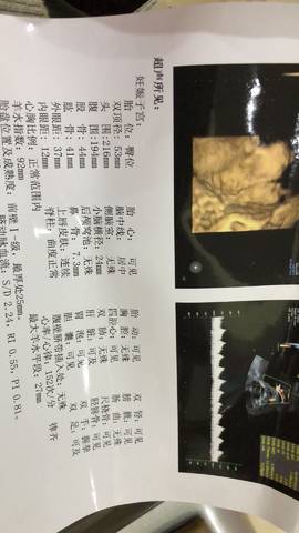 journal_insert_pic_935493759