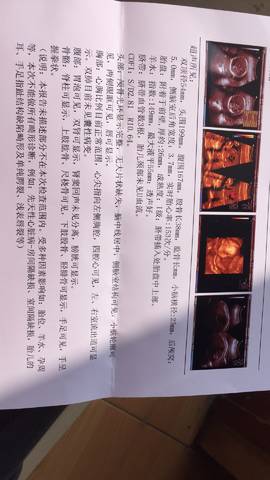 journal_insert_pic_935847077