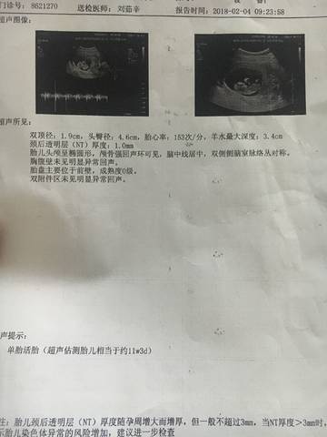 journal_insert_pic_938585163