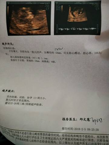 journal_insert_pic_939069818