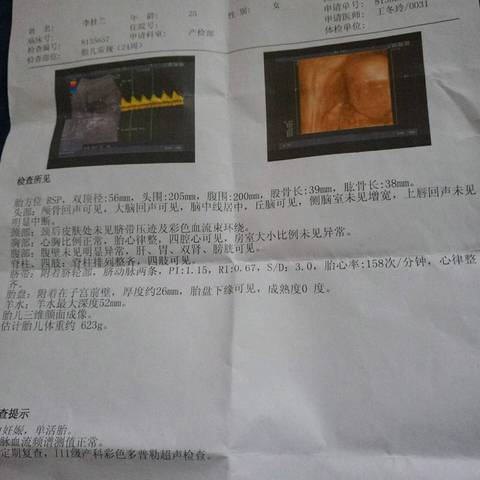 journal_insert_pic_939315698