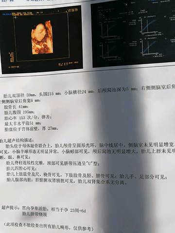 journal_insert_pic_939740369
