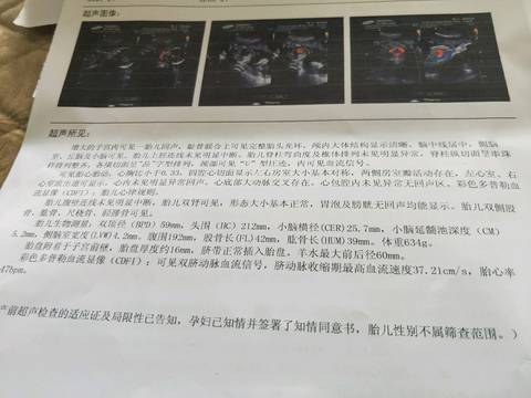 journal_insert_pic_940830120