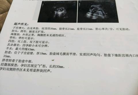 journal_insert_pic_940830110