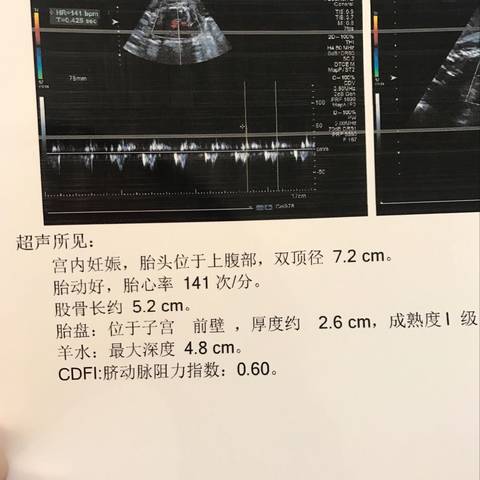 journal_insert_pic_941386381