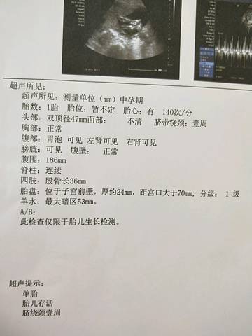 journal_insert_pic_943991938