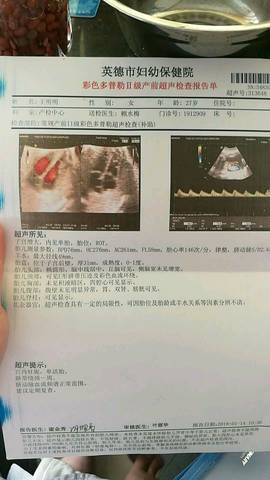 journal_insert_pic_948014747