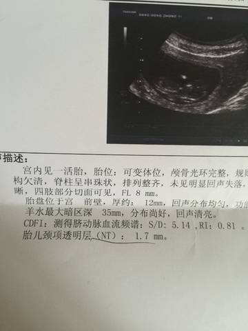 journal_insert_pic_948739609