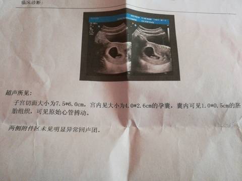 journal_insert_pic_950550330