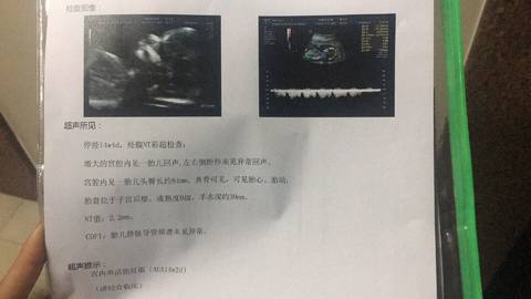 journal_insert_pic_950716254