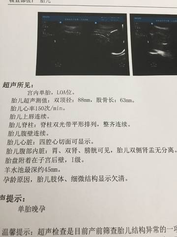 journal_insert_pic_952182535