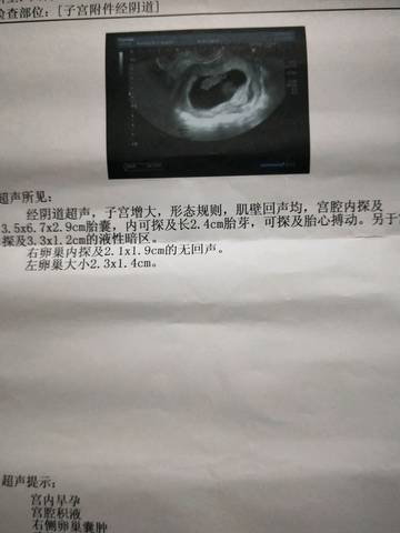 journal_insert_pic_954405214