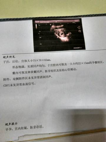 journal_insert_pic_955726061