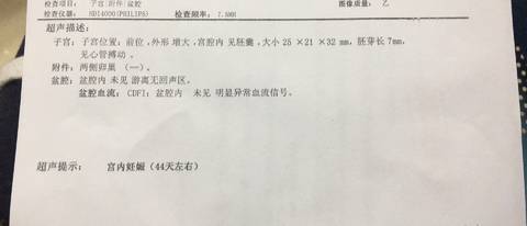 journal_insert_pic_957150585