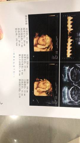 journal_insert_pic_958736706