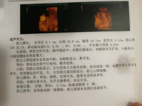 journal_insert_pic_959571568