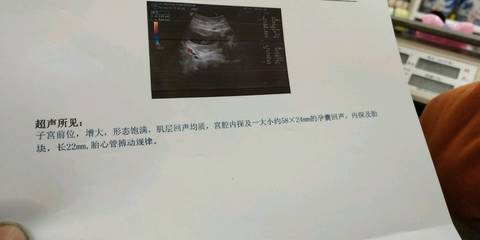 journal_insert_pic_960849146