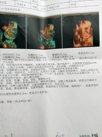 journal_insert_pic_961288751