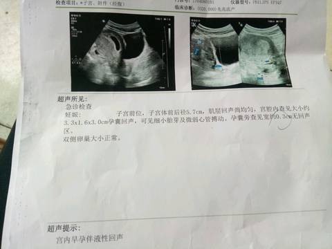 journal_insert_pic_963485176