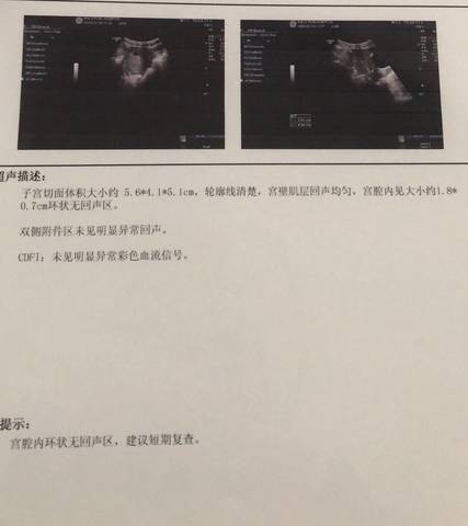 journal_insert_pic_965159874