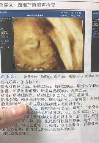 journal_insert_pic_965230712
