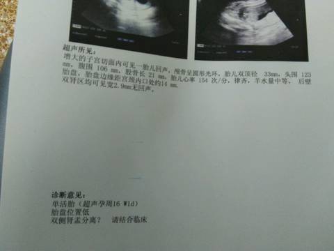 journal_insert_pic_965696887