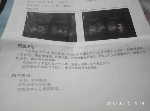 journal_insert_pic_967584358