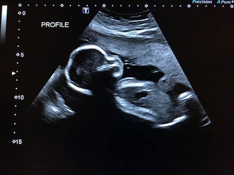 journal_insert_pic_970917299