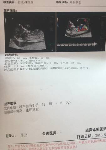 journal_insert_pic_971599559