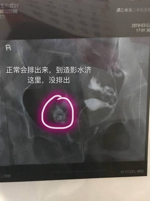 辅助生殖技术的发展与未来展望