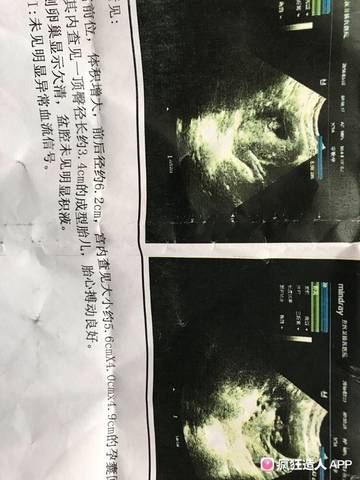 journal_insert_pic_972934224