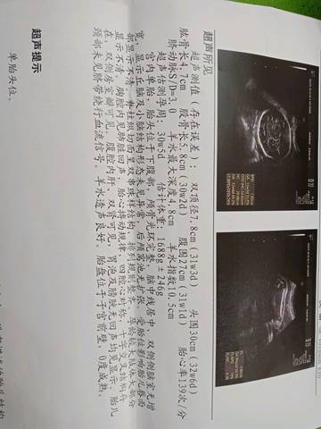 journal_insert_pic_973157456