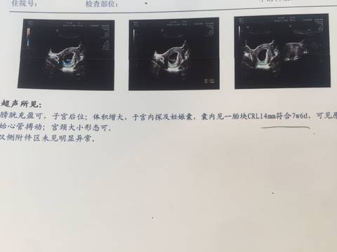 journal_insert_pic_973351126