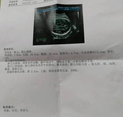 journal_insert_pic_973610869
