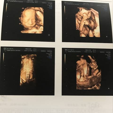 journal_insert_pic_975601414