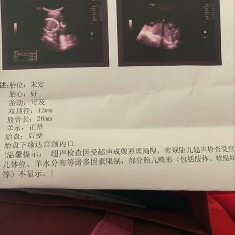 journal_insert_pic_976292679