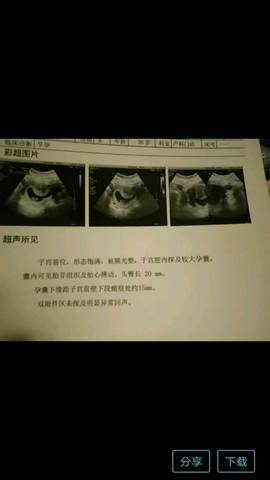 journal_insert_pic_975974563