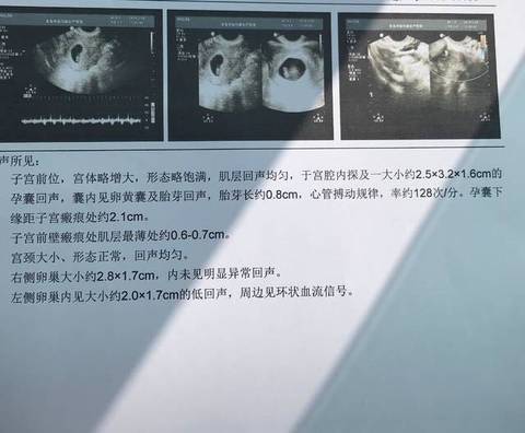 journal_insert_pic_978164703