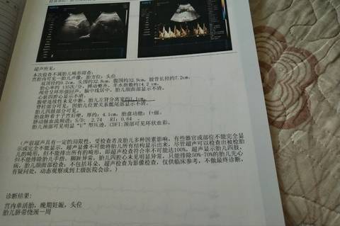 journal_insert_pic_978581154