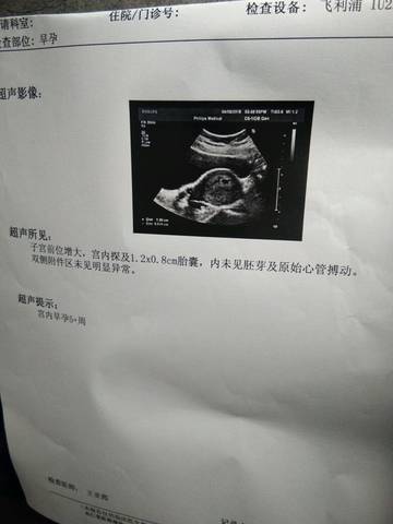 journal_insert_pic_983056453