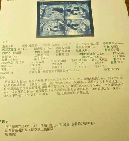 journal_insert_pic_984019689