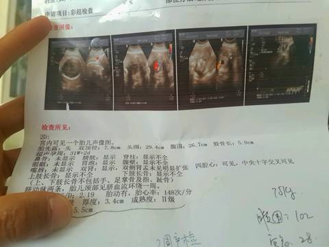 journal_insert_pic_985345153