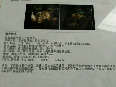 journal_insert_pic_986130004