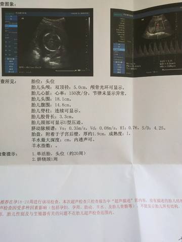 journal_insert_pic_986638045