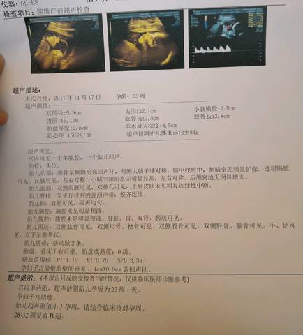 journal_insert_pic_986779648